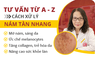 Tư vấn