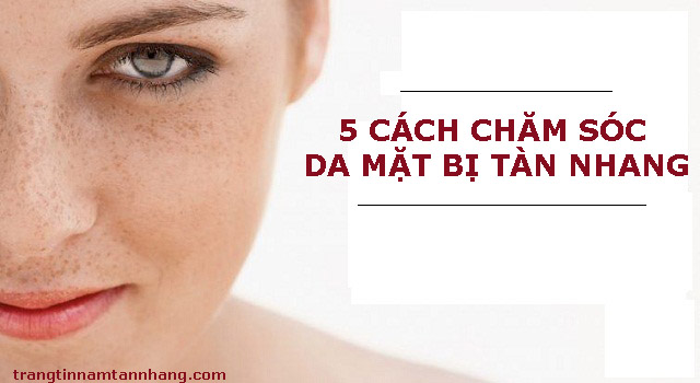 Cách chăm sóc da mặt bị tàn nhang