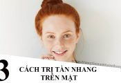 Cách chữa tàn nhang trên mặt