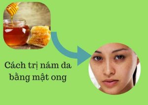 Cách trị nám da bằng mật ong