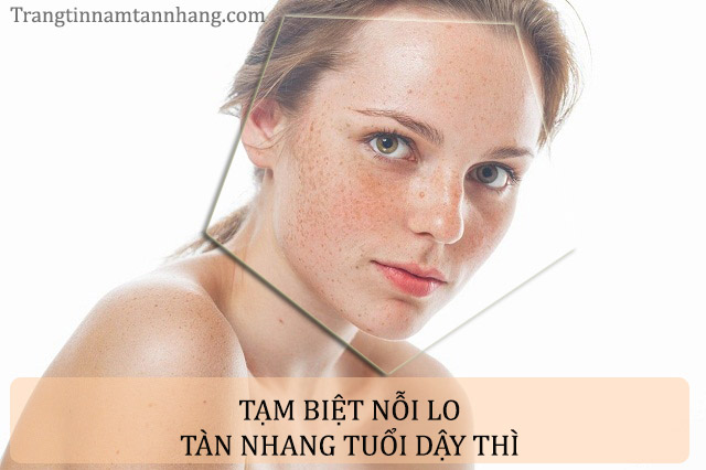 Cách trị tàn nhang tuổi dậy thì