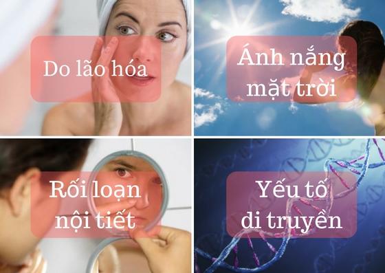 cách trị tàn nhang