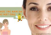 8 cách trị nám da bằng mật ong
