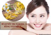 Bí quyết trị nám da bằng vitamin E