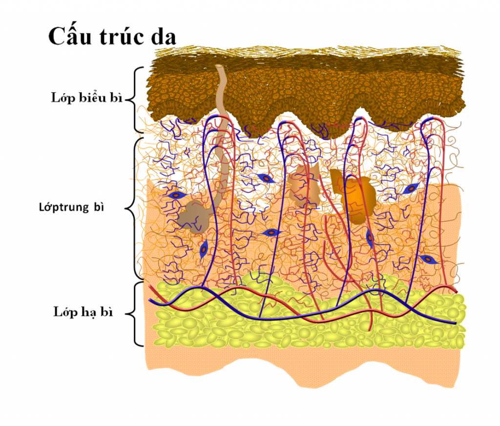 Nám da lâu năm khó điều trị