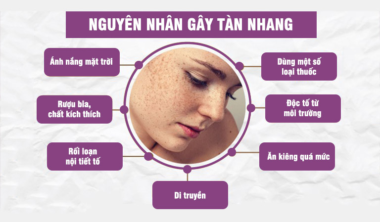 Tàn nhang xuất hiện do nhiều nguyên nhân gây nên