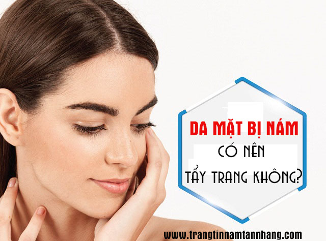 Da mặt bị nám có nên tẩy trang không?