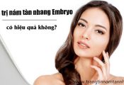 Dùng kem trị nám tàn nhang Embryo bao lâu thì khỏi ?