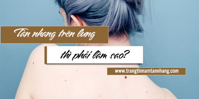 Phải làm sao khi xuất hiện tàn nhang trên lưng