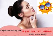 Sạm da do nắng phải làm sao ?