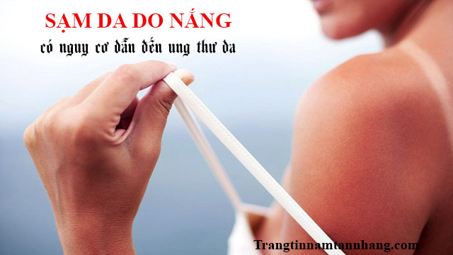 Sạm da do nắng phải làm sao ?