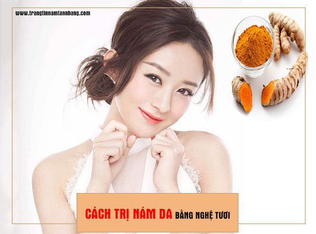 Cách trị nám da bằng nghệ tươi