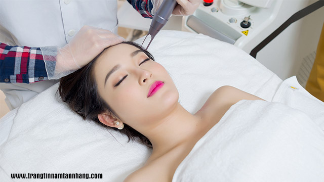 Bắn tàn nhang bằng tia Laser giá bao nhiêu ?