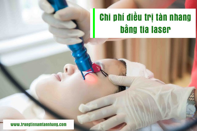 Bắn tàn nhang bằng tia Laser giá bao nhiêu ?