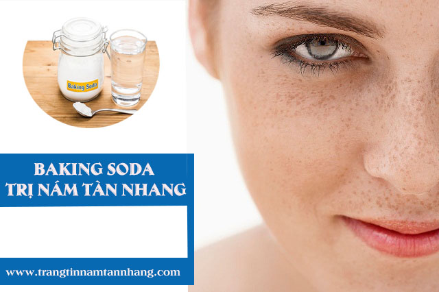 Cách dùng baking soda trị nám tàn nhang