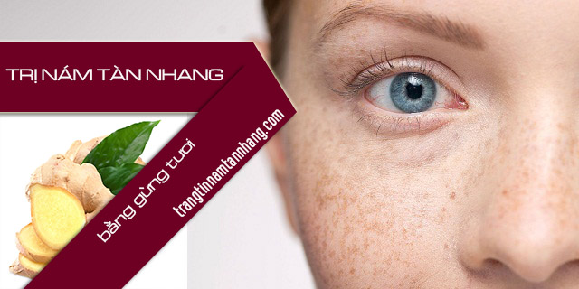 Cách trị nám tàn nhang bằng gừng tươi