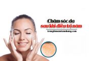 chăm sóc da sau khi điều trị nám