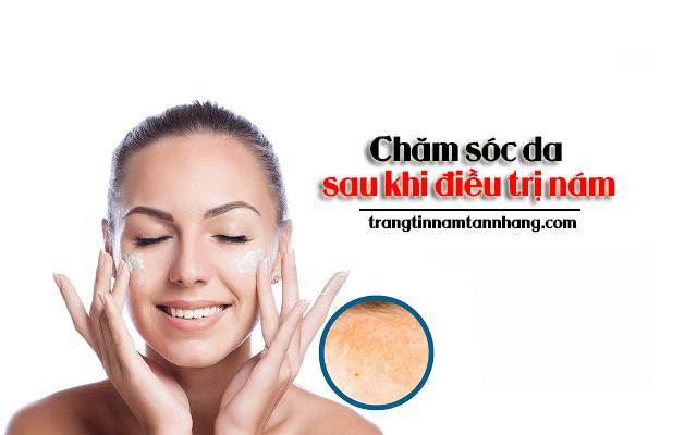 chăm sóc da sau khi điều trị nám