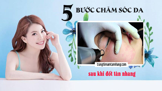 5 bước chăm sóc da sau khi đốt tàn nhang