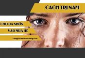 Bật mí cách trị nám cho da nhờn vào mùa hè