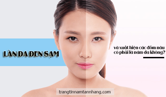 Da đen sạm và xuất hiện các đốm nâu mờ mờ có phải bị nám da