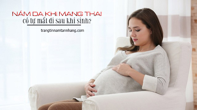 Mang bầu bị nám thì sau sinh có bị nám không?