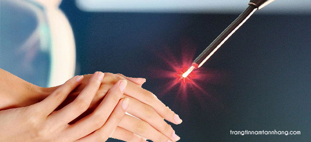 Nám xuất hiện ở mu bàn tay điều trị thế nào?