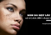Nám da mặt lâu năm
