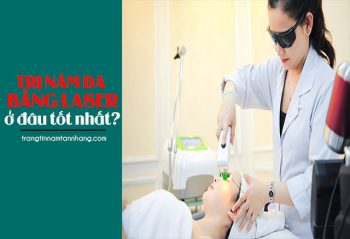 Điều trị nám bằng laser ở đâu tốt và uy tín nhất?