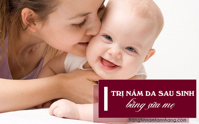 Cách trị nám sau sinh bằng sữa mẹ