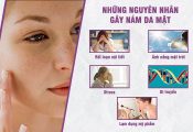 Có rất nhiều nguyên nhân gây ra tình trạng nám da