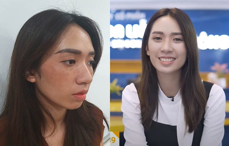 Tình trạng tàn nhàng của Thanh Vân trước và sau khi sử dụng Vương Phi