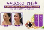 Hiệu quả loại bỏ nám của cựu quân nhân 47 tuổi