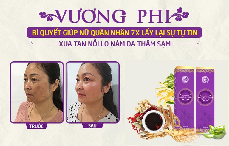 Cô Vân tự tin với diện mạo mới sau khi sử dụng một liệu trình Vương Phi