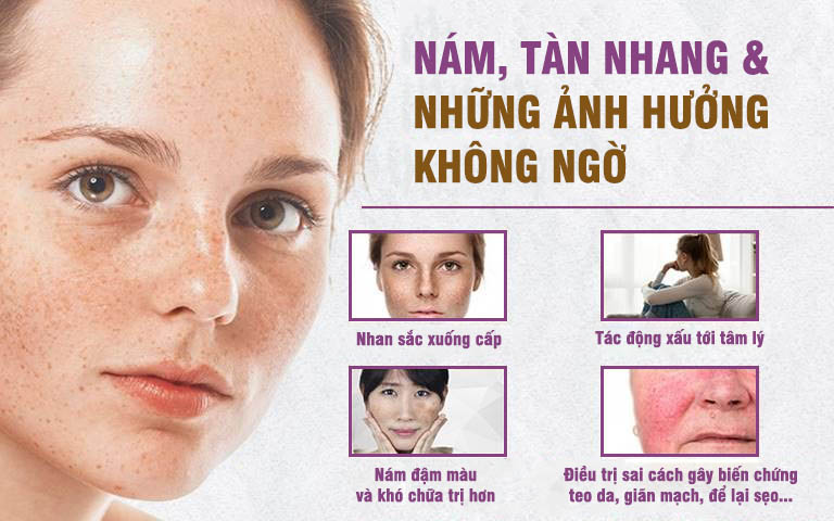 Tàn nhang khiến cho "khổ chủ" cảm thấy tự ti