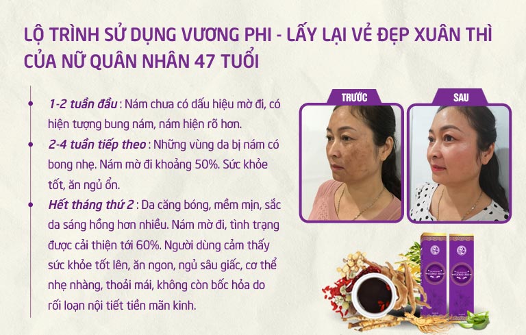 Khách hàng 47 tuổi trẻ như 40 sau liệu trình sử dụng Vương Phi