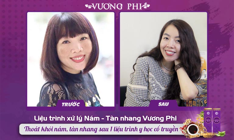 Làn da của diễn giả Phan Hồ Điệp trước và sau khi dùng Vương Phi