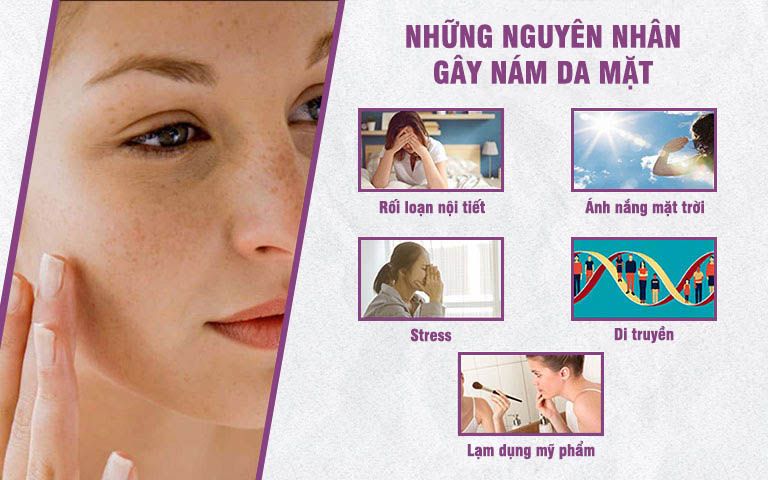 Những nguyên nhân chính hình thành sạm nám