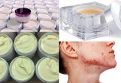 Kem trộn tiềm ẩn nhiều nguy cơ cho làn da và sức khỏe tổng thể, phục hồi da sau khi dùng kem trộn không hề dễ dàng