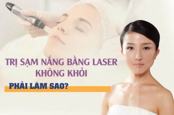 Trị sạm nắng bằng laser không khỏi phải làm sao?