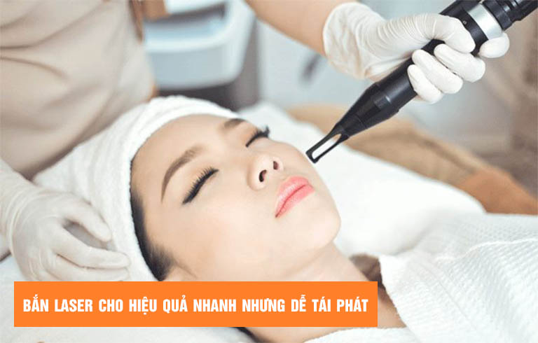 Xử lý nám da bằng laser thường cho hiệu quả nhanh nhưng dễ tái phát