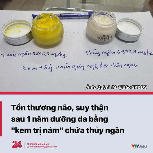 Ngộ độc thủy ngân do dùng kem xử lý nám da không rõ nguồn gốc