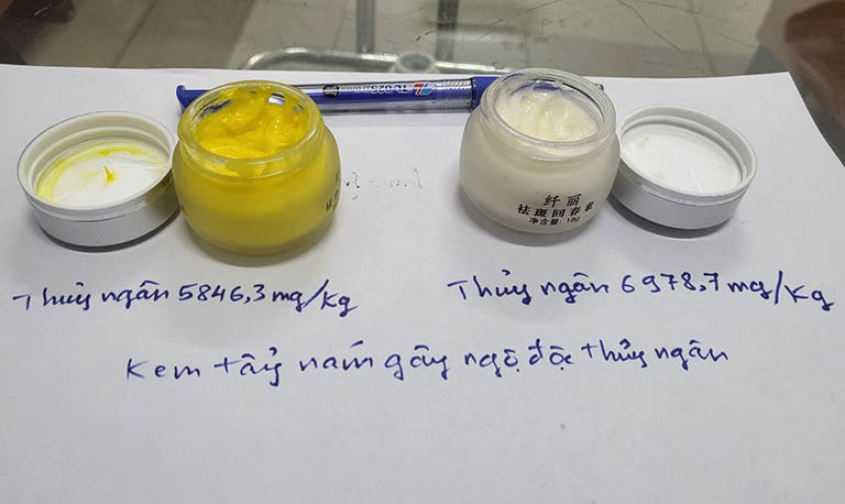 Xử lý nám da tại nhà với sản phẩm kém chất lượng tiềm ẩn nguy cơ ngộ độc thủy ngân