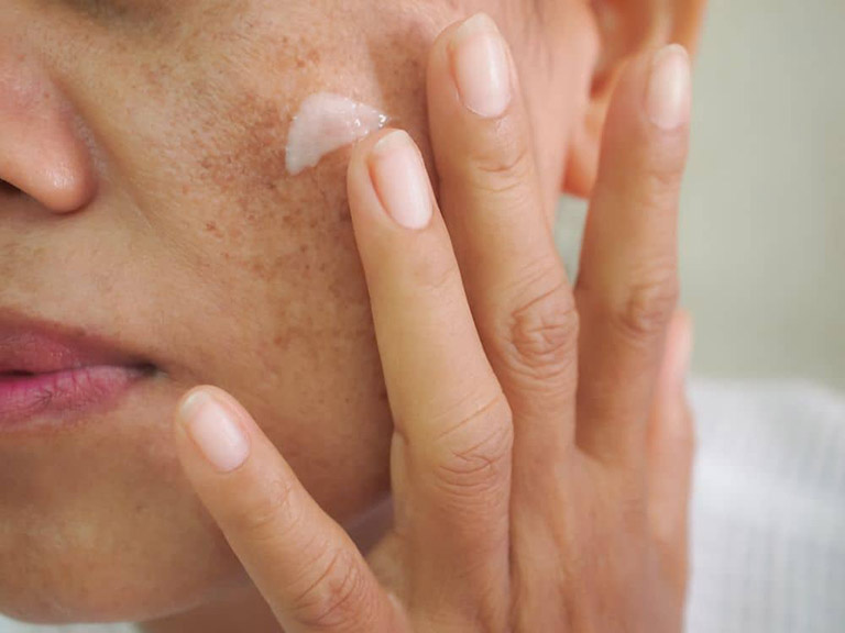 Nha đam chỉ phù hợp với tình trạng nám nhẹ, mới chớm