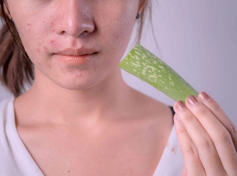 Nha đam có thể gây kích ứng da nếu dùng không đúng cách, da nhạy cảm