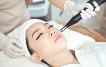 Xử lý tàn nhang bằng công nghệ cao có hiệu quả không? Có hết tàn nhang không?